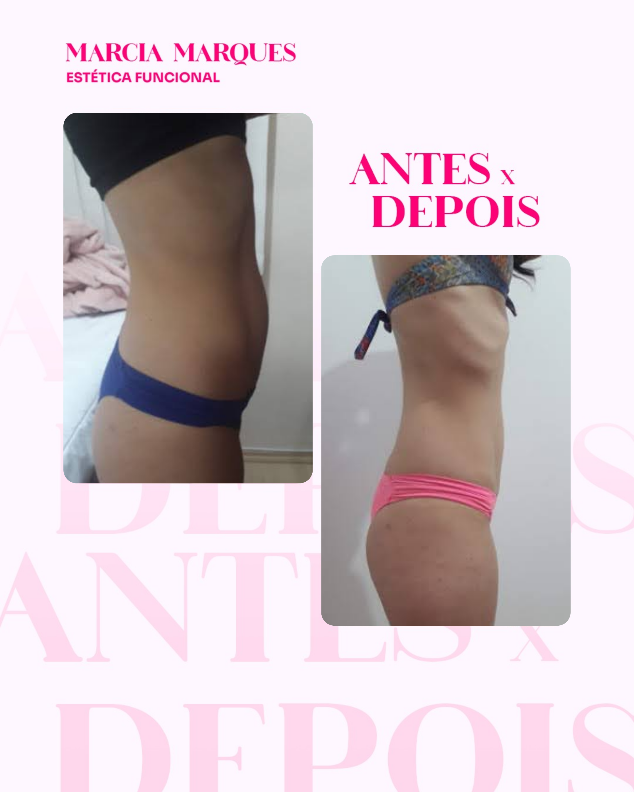 Antes e Depois 7